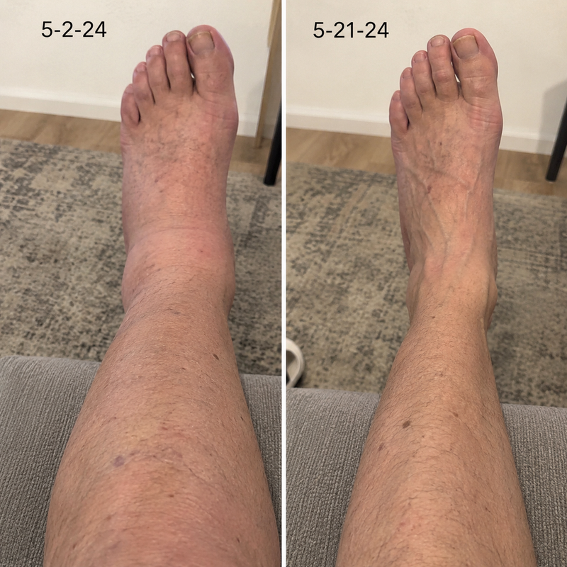 using Trysoviren less than 8 weeks