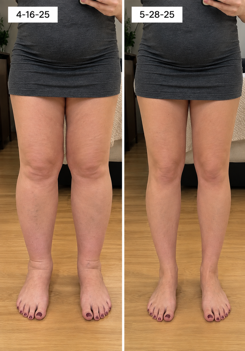 using Trysoviren less than 8 weeks