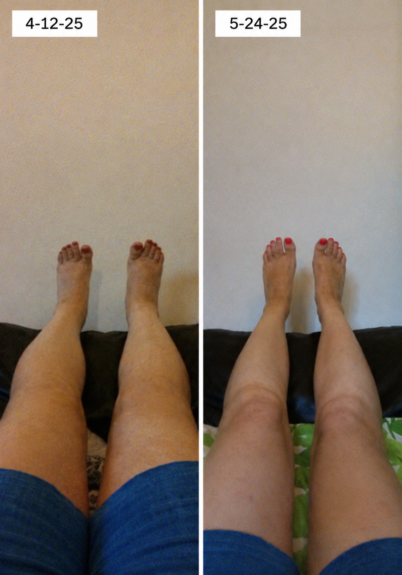 using Trysoviren less than 8 weeks