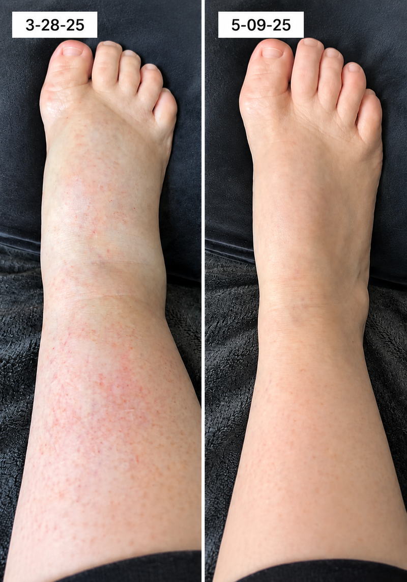 using Trysoviren less than 8 weeks
